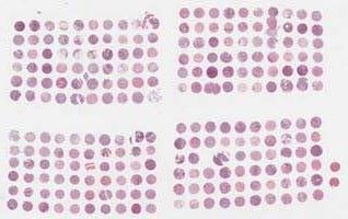 Tissue microarray